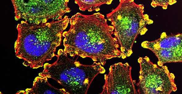 Cancer cells via microscope